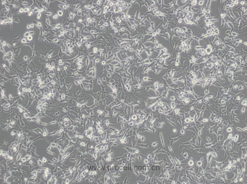 NIT-1 (小鼠胰島素瘤β細(xì)胞)(暫不出售)