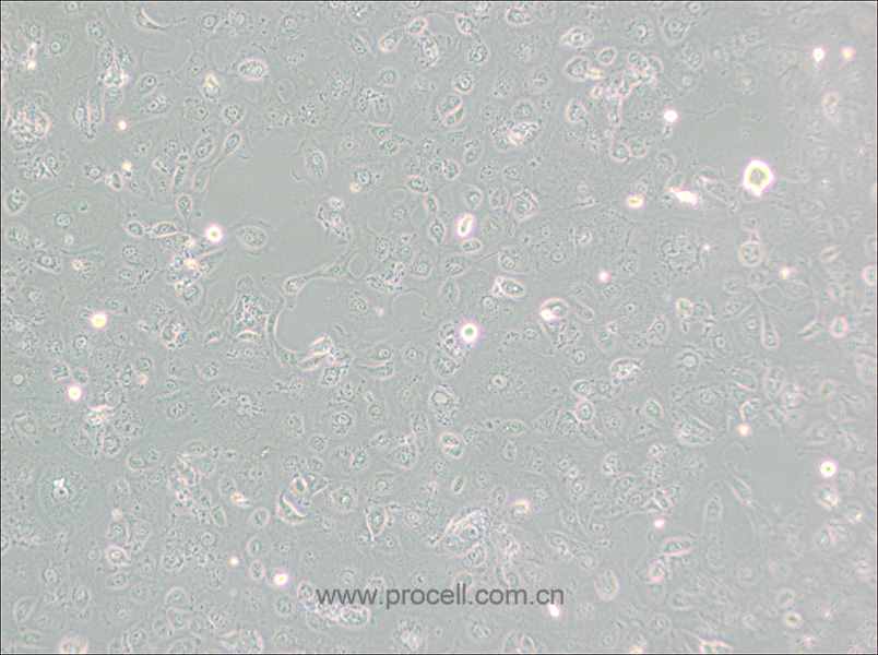 MARC-145 [Marc-145; Marc 145; Marc145] (非洲綠猴胚胎腎細胞)(種屬鑒定正確)