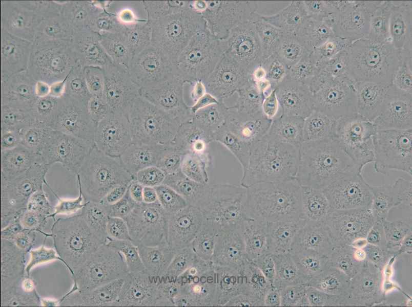 MARC-145 [Marc-145; Marc 145; Marc145] (非洲綠猴胚胎腎細(xì)胞)(種屬鑒定正確)