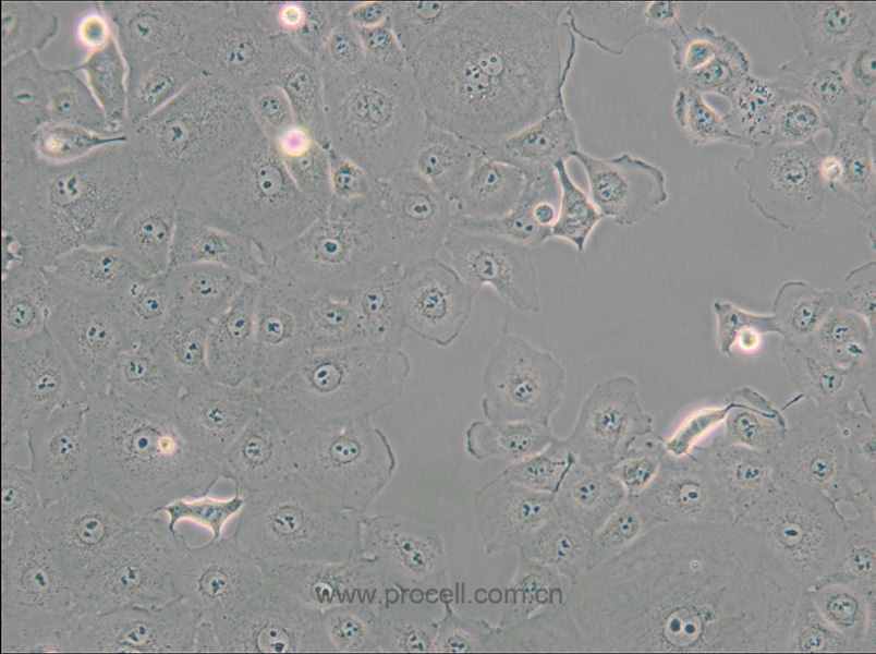 MARC-145 [Marc-145; Marc 145; Marc145] (非洲綠猴胚胎腎細(xì)胞)(種屬鑒定正確)