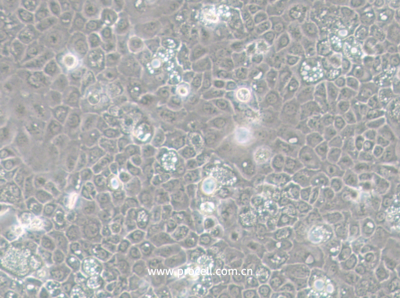 SCC-25 [SCC 25; SCC25] (人舌鱗癌細(xì)胞)(STR鑒定正確)