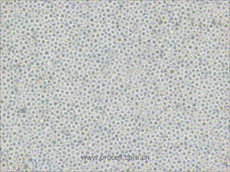 MV-4-11 (人髓性單核細(xì)胞白血病細(xì)胞) (STR鑒定正確)