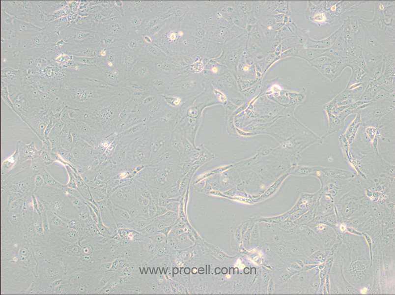 MKN-7 [MKN7; MKN 7] (人胃癌細(xì)胞) (STR鑒定正確)