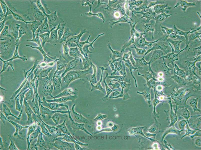 KYSE-410 (人食管鱗癌細(xì)胞) (STR鑒定正確)