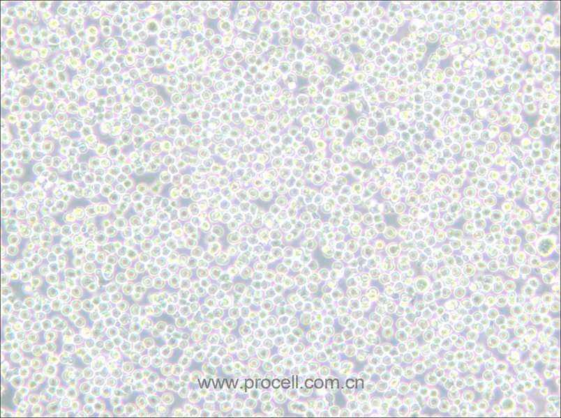 BALL-1 (人B淋巴細胞急性白血病) (STR鑒定正確)