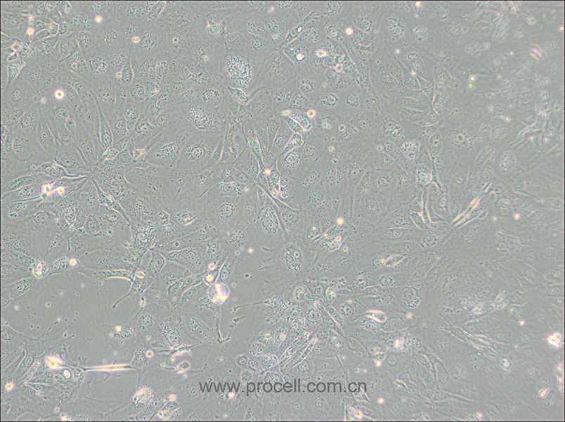 NCI-H2347 (人肺癌細(xì)胞) (STR鑒定正確)
