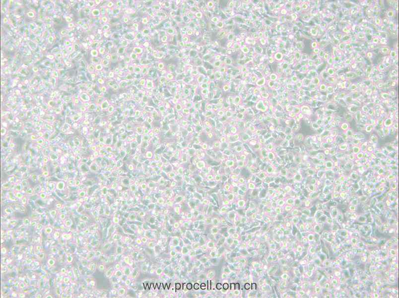 MM.1S (人多發(fā)性骨髓瘤細(xì)胞) (STR鑒定正確)