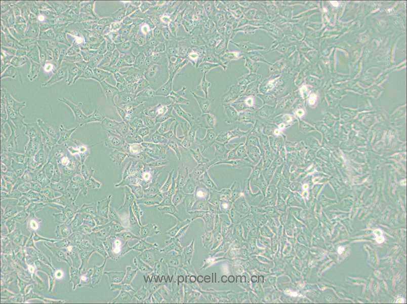 KMH-2 (人甲狀腺癌細(xì)胞(未分化)) (STR鑒定正確)