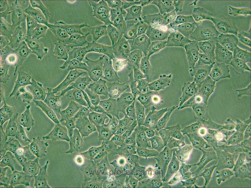 KMH-2 (人甲狀腺癌細(xì)胞(未分化)) (STR鑒定正確)
