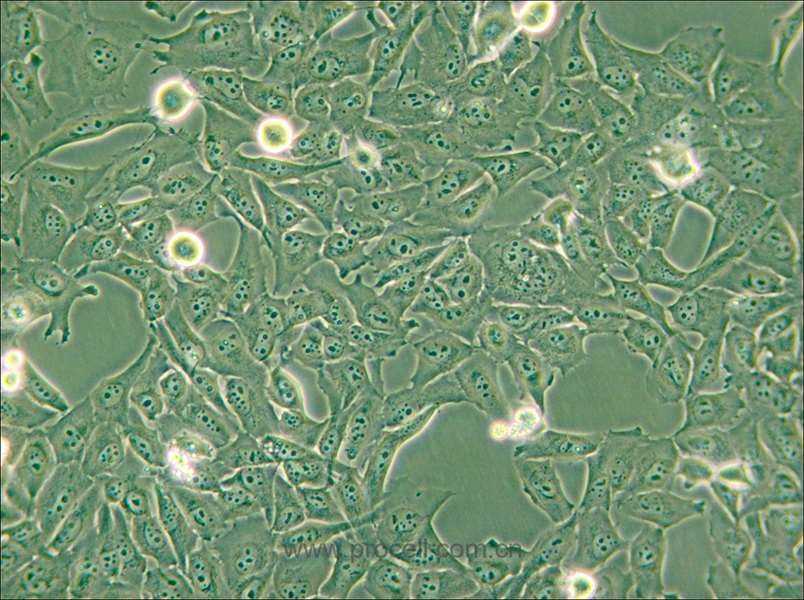 KMH-2 (人甲狀腺癌細(xì)胞(未分化)) (STR鑒定正確)