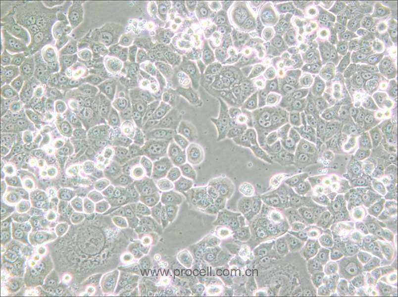 NCI-H2126 (人肺癌細胞) (STR鑒定正確)
