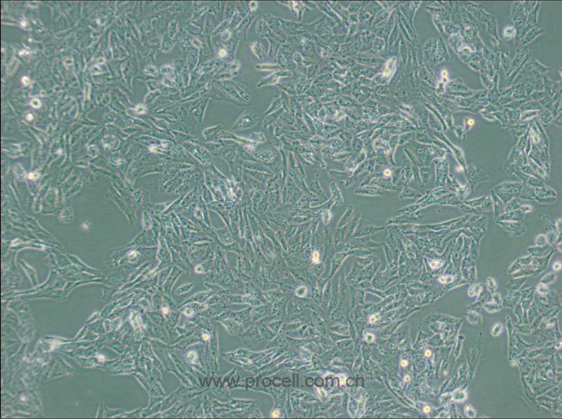 NCI-H647 (人肺癌細(xì)胞) (STR鑒定正確)