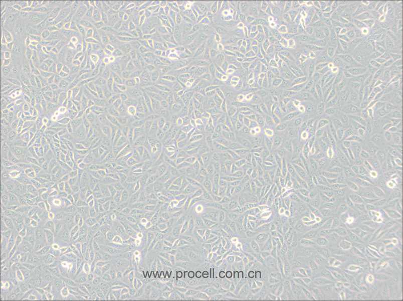 TPC-1 (人甲狀腺癌細(xì)胞) (STR鑒定正確)