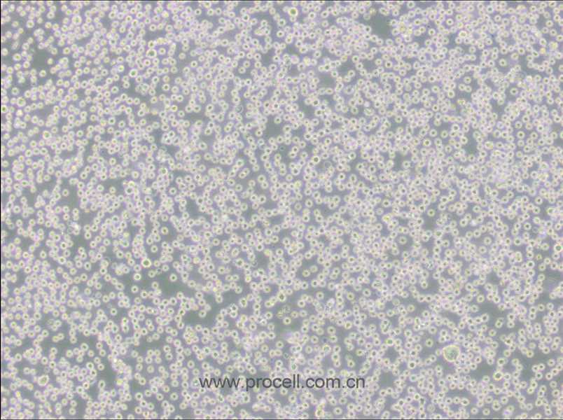 DB (彌漫大B細(xì)胞淋巴瘤細(xì)胞) (STR鑒定正確)