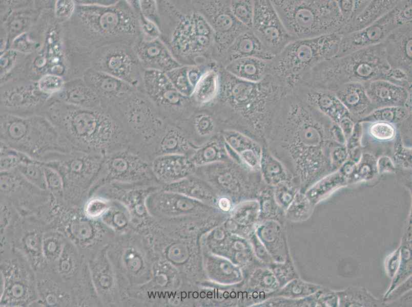 ACT-1 (人甲狀腺癌細(xì)胞) (STR鑒定正確)