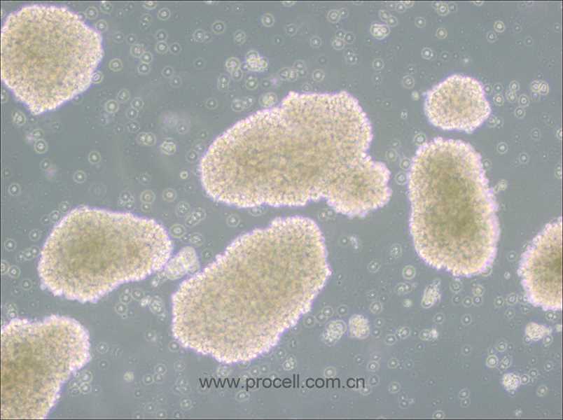 MT-4 (人T細(xì)胞白血病細(xì)胞) (STR鑒定正確)(僅提供凍存管)