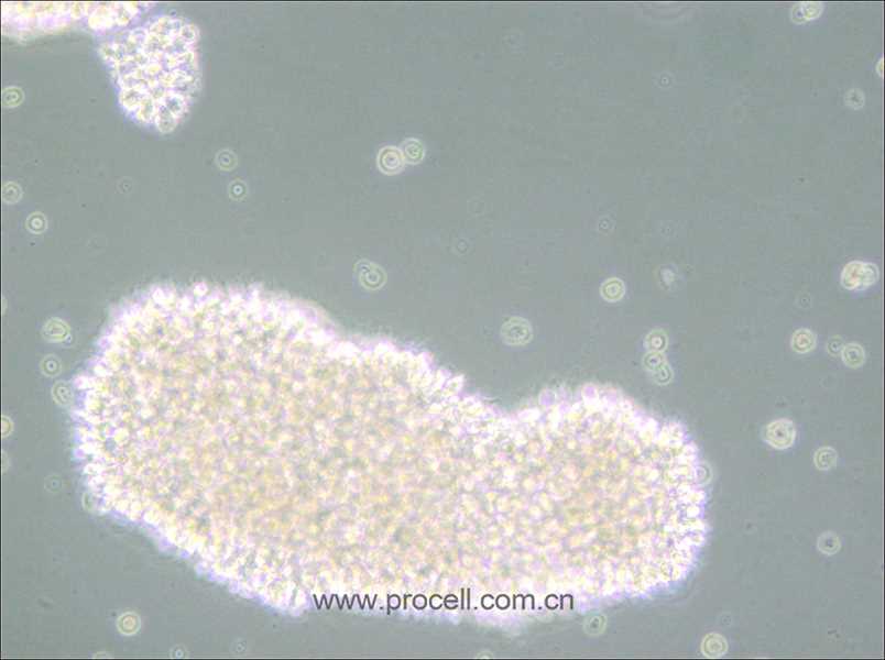 MT-4 (人T細(xì)胞白血病細(xì)胞) (STR鑒定正確)(僅提供凍存管)