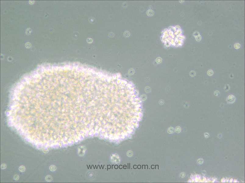 MT-4 (人T細(xì)胞白血病細(xì)胞) (STR鑒定正確)(僅提供凍存管)