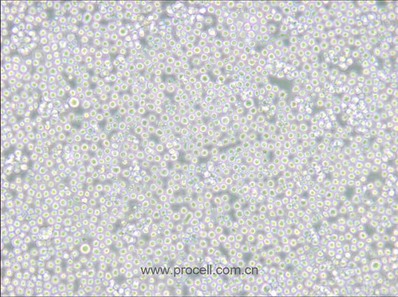 MEL (小鼠紅白血病細(xì)胞) (STR鑒定正確)