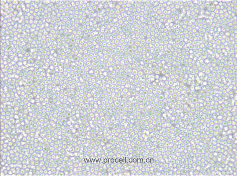 MEL (小鼠紅白血病細(xì)胞) (STR鑒定正確)