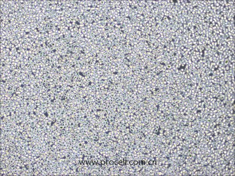 NB4 (人急性早幼粒細(xì)胞白血病細(xì)胞) (STR鑒定正確)