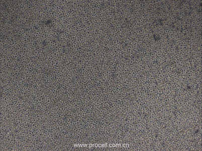 MOLM-13 (人急性髓性白血病細(xì)胞) (STR鑒定正確)