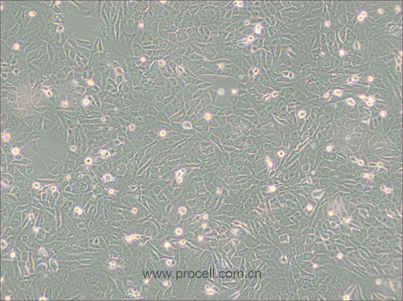 SW872 (人脂肪肉瘤細(xì)胞) (STR鑒定正確)