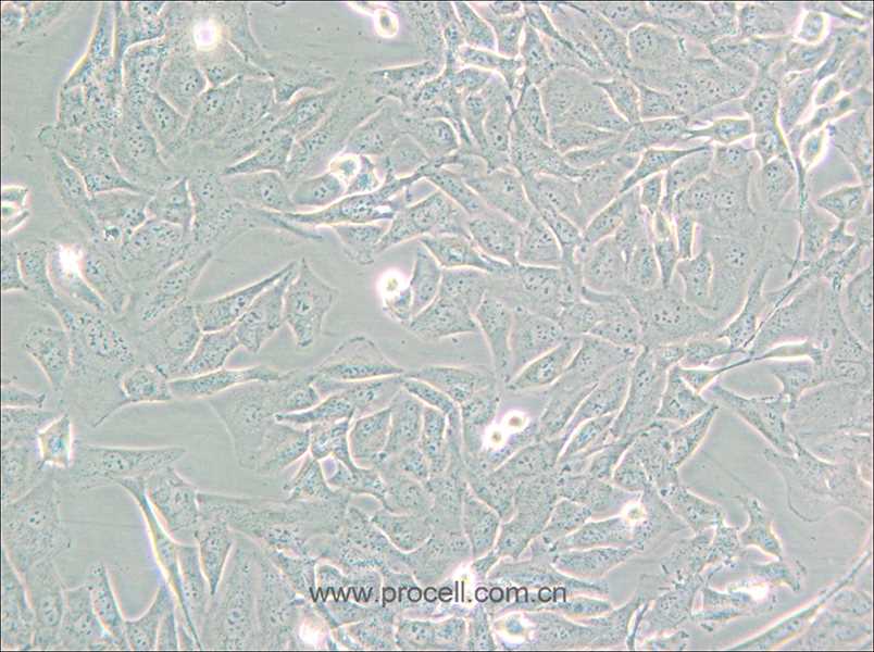 SW872 (人脂肪肉瘤細(xì)胞) (STR鑒定正確)