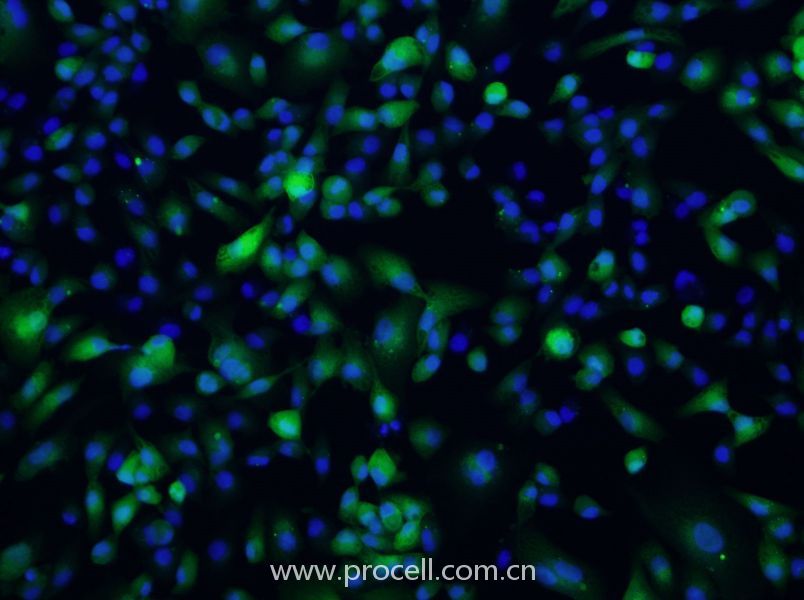 ACHN/GFP (人腎細(xì)胞腺癌細(xì)胞(綠色熒光標(biāo)記)) (STR鑒定正確)