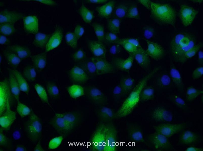 ACHN/GFP (人腎細(xì)胞腺癌細(xì)胞(綠色熒光標(biāo)記)) (STR鑒定正確)