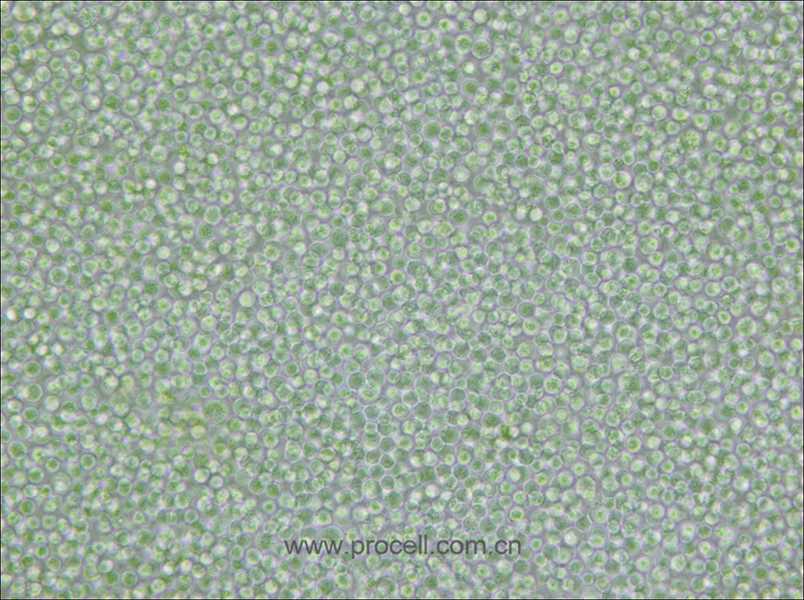 SU-DHL-4 (人B淋巴瘤細(xì)胞) (STR鑒定正確)