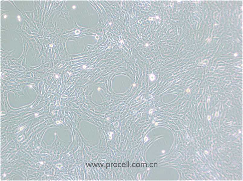 HT22 (小鼠海馬神經(jīng)元細胞) (STR鑒定正確)