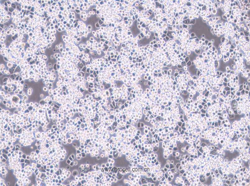 MDA-kb2 (人乳腺癌細(xì)胞) (STR鑒定正確)