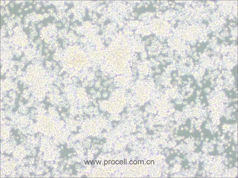 EL-4-B5 (小鼠胸腺淋巴瘤細(xì)胞) (種屬鑒定正確)