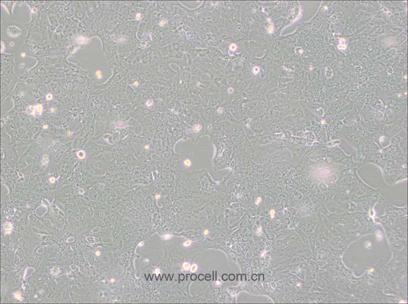 Capan-1 (人胰腺癌細(xì)胞) (STR鑒定正確)