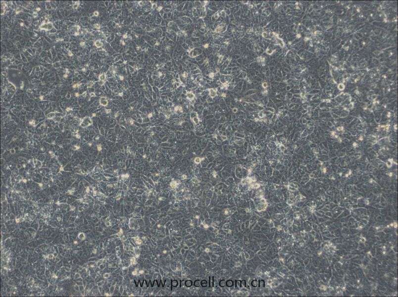 NTERA-2 (人惡性多發(fā)性畸胎瘤細(xì)胞) (STR鑒定正確)