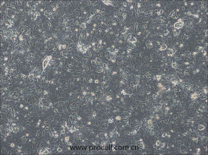 NTERA-2 (人惡性多發(fā)性畸胎瘤細(xì)胞) (STR鑒定正確)