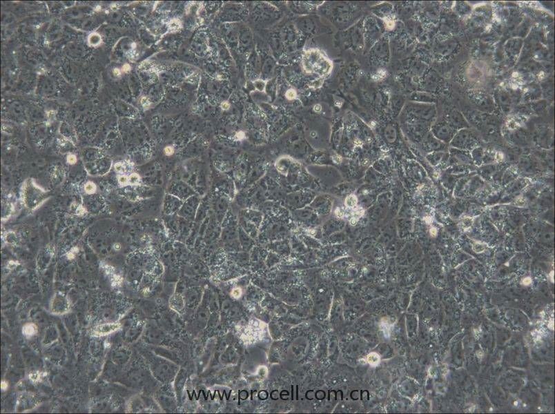 NTERA-2 (人惡性多發(fā)性畸胎瘤細(xì)胞) (STR鑒定正確)