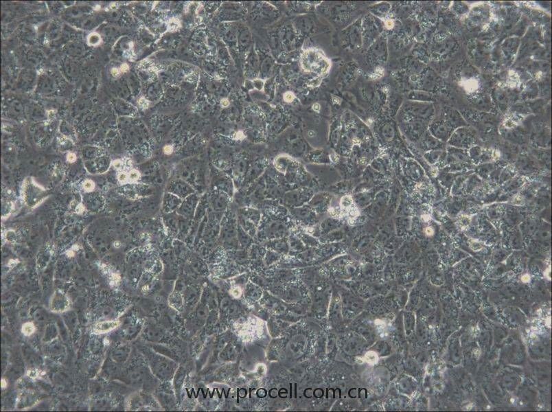 NTERA-2 (人惡性多發(fā)性畸胎瘤細(xì)胞) (STR鑒定正確)