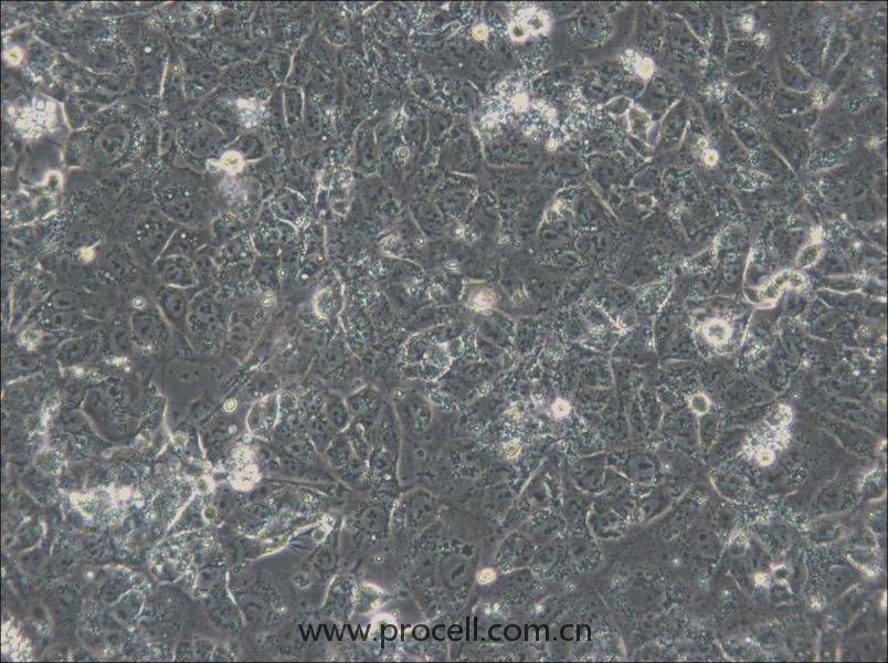 NTERA-2 (人惡性多發(fā)性畸胎瘤細(xì)胞) (STR鑒定正確)