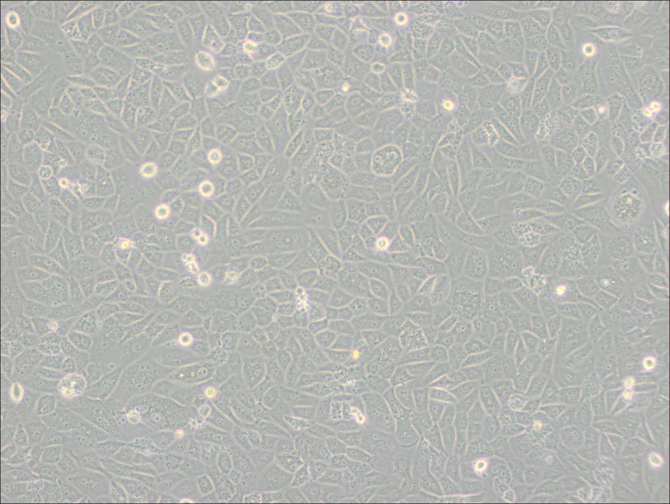 SK-LU-1 (人低分化肺腺癌細胞) (STR鑒定正確)