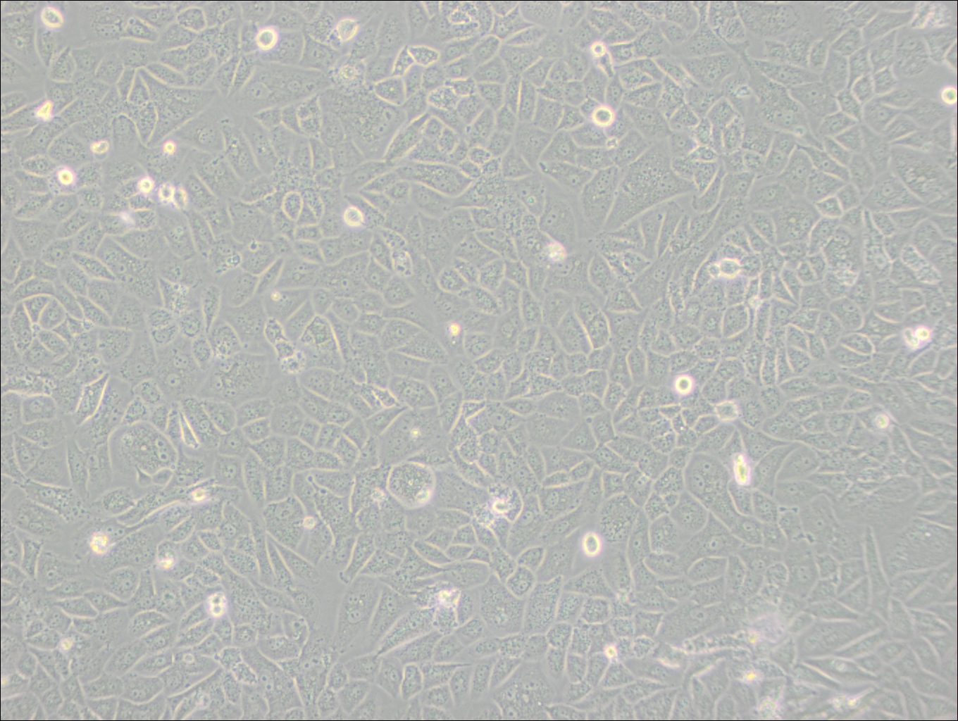 SK-LU-1 (人低分化肺腺癌細(xì)胞) (STR鑒定正確)