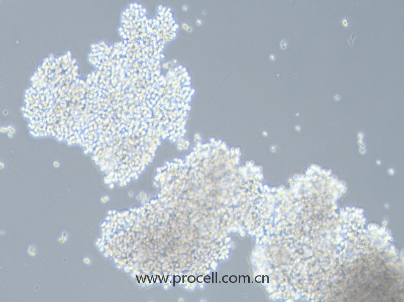 SHP-77(人小細(xì)胞肺癌細(xì)胞)(STR鑒定正確)