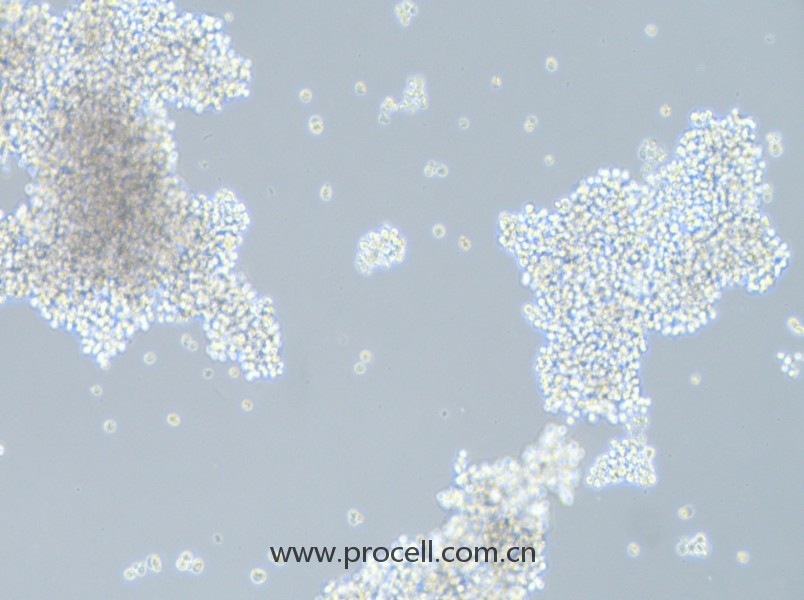 SHP-77(人小細(xì)胞肺癌細(xì)胞)(STR鑒定正確)