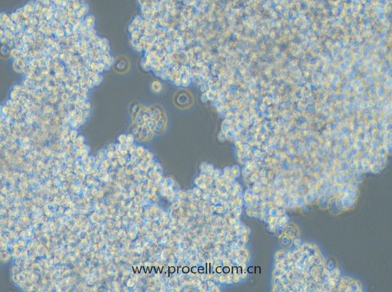 SHP-77(人小細(xì)胞肺癌細(xì)胞)(STR鑒定正確)