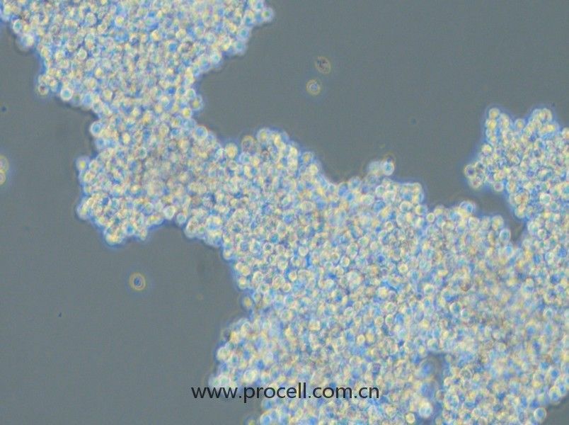 SHP-77(人小細(xì)胞肺癌細(xì)胞)(STR鑒定正確)