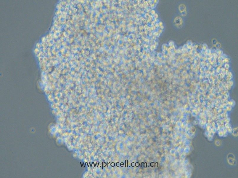 SHP-77(人小細(xì)胞肺癌細(xì)胞)(STR鑒定正確)