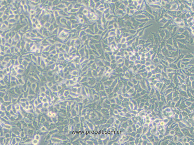 NCI-H3122 (人非小細胞肺癌細胞) (STR鑒定正確)