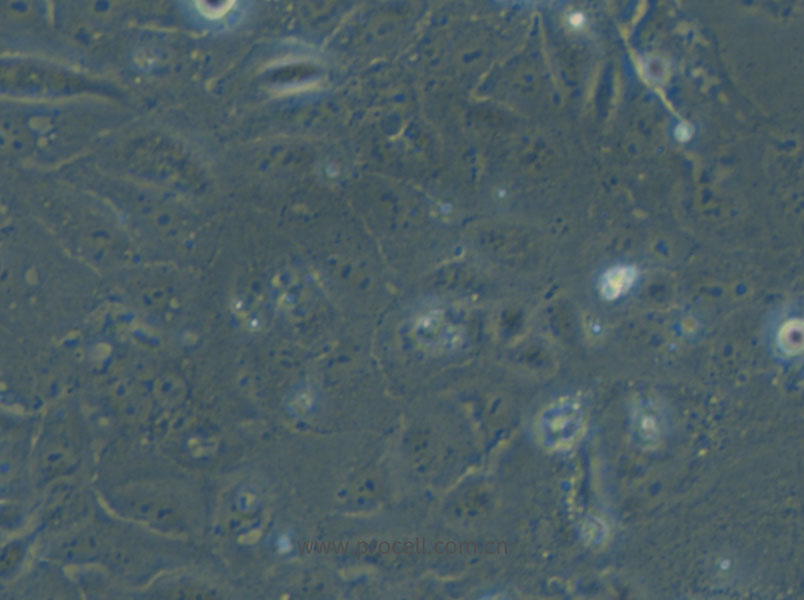 HuCC-T1 (人膽管癌細胞) (STR鑒定正確)