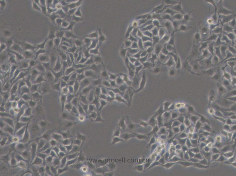 HCC1806 (人乳腺鱗狀癌細(xì)胞) (STR鑒定正確)
